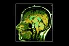 Why Your Brain Is A Quantum Computer Why Your Brain Is A Quantum Computer